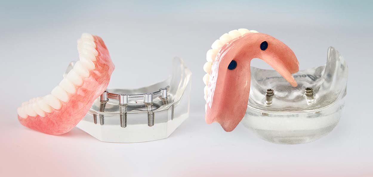 Dentist using a denture gauge to ensure a precise fit for dental appliances