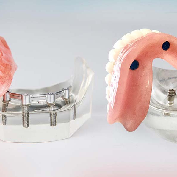 Dentist using a denture gauge to ensure a precise fit for dental appliances