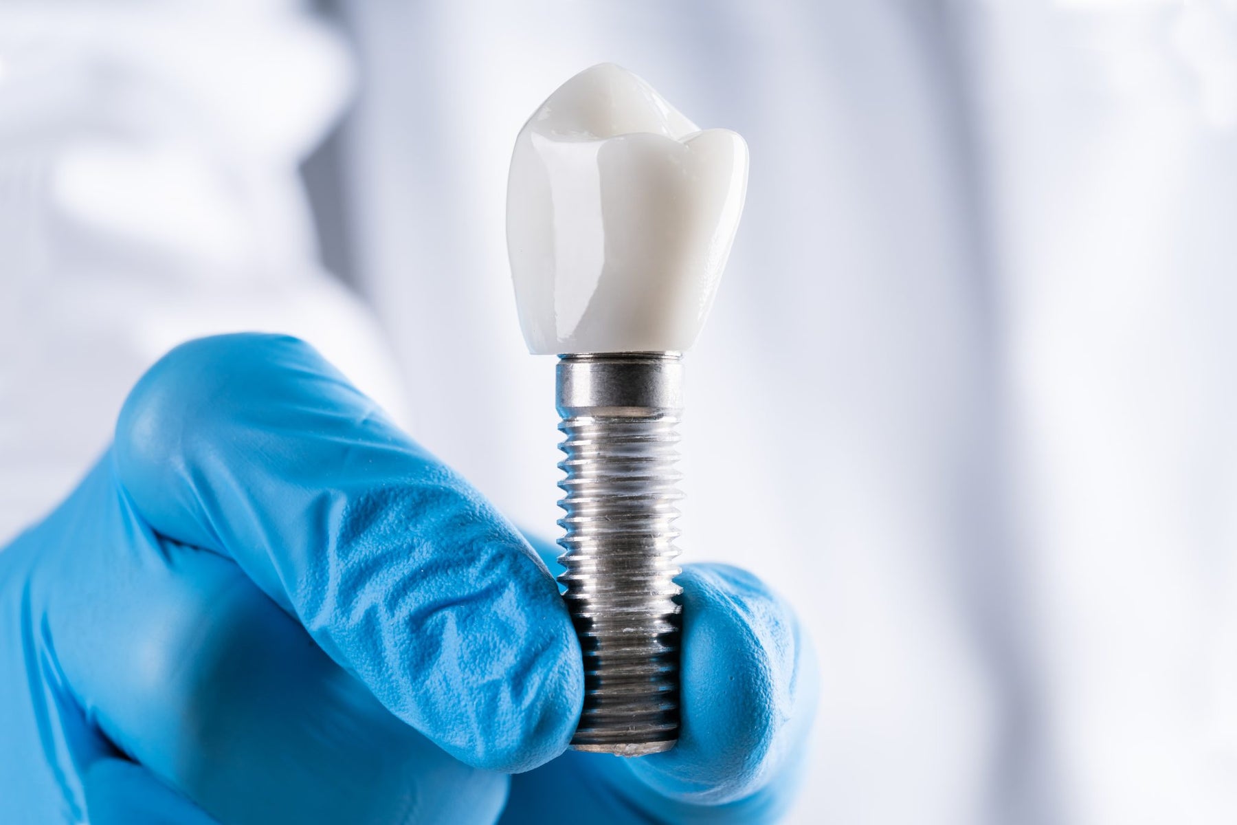 Choosing Between Dental Implants and Dentures